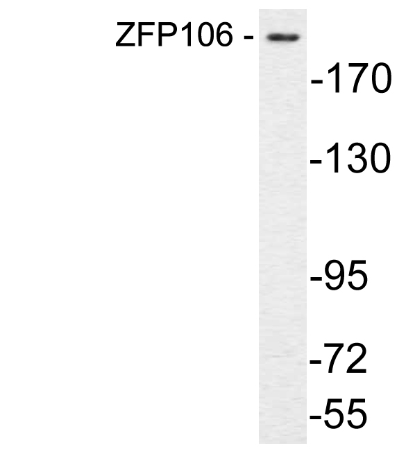 Western blot analysis of lysate from COS7 cells, using ZFP106 antibody