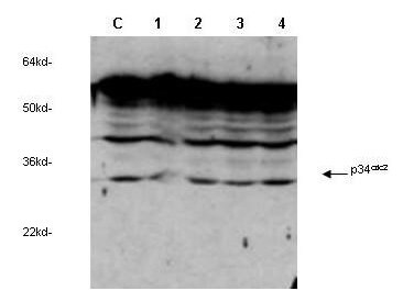 Boster's anti-cdc2 Cyclin Dependent Kinase was used to detect human p34cdc2 by western blot in untreated (Control) and drug treated lysates of MCF-7 cells