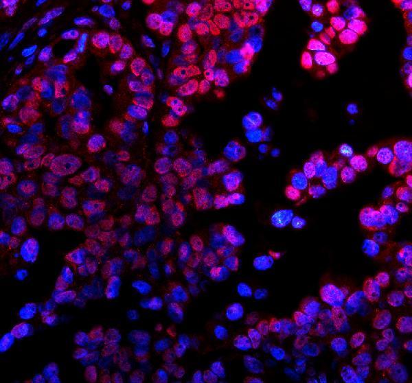 a31256 h2az1 primary antibodies if testing 2