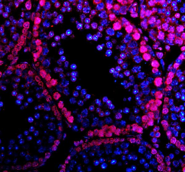 a31256 h2az1 primary antibodies if testing 3