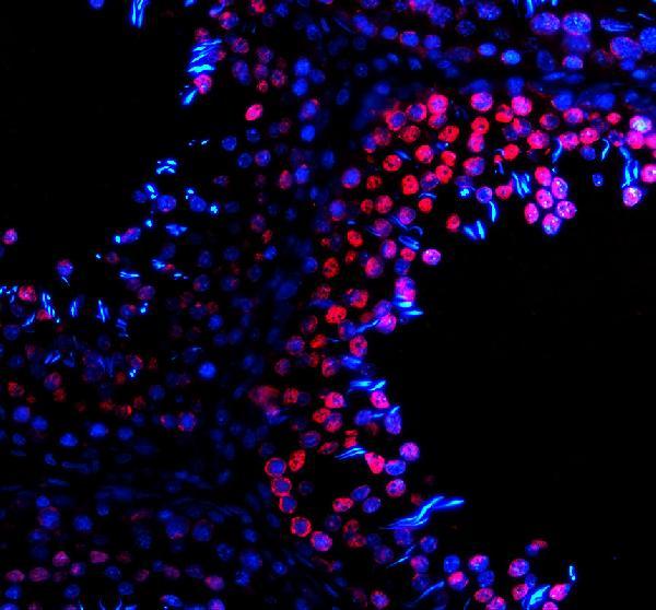 a31256 h2az1 primary antibodies if testing 4