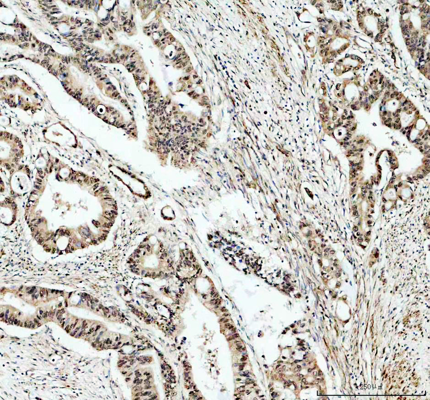 IHC analysis of Histone H2A