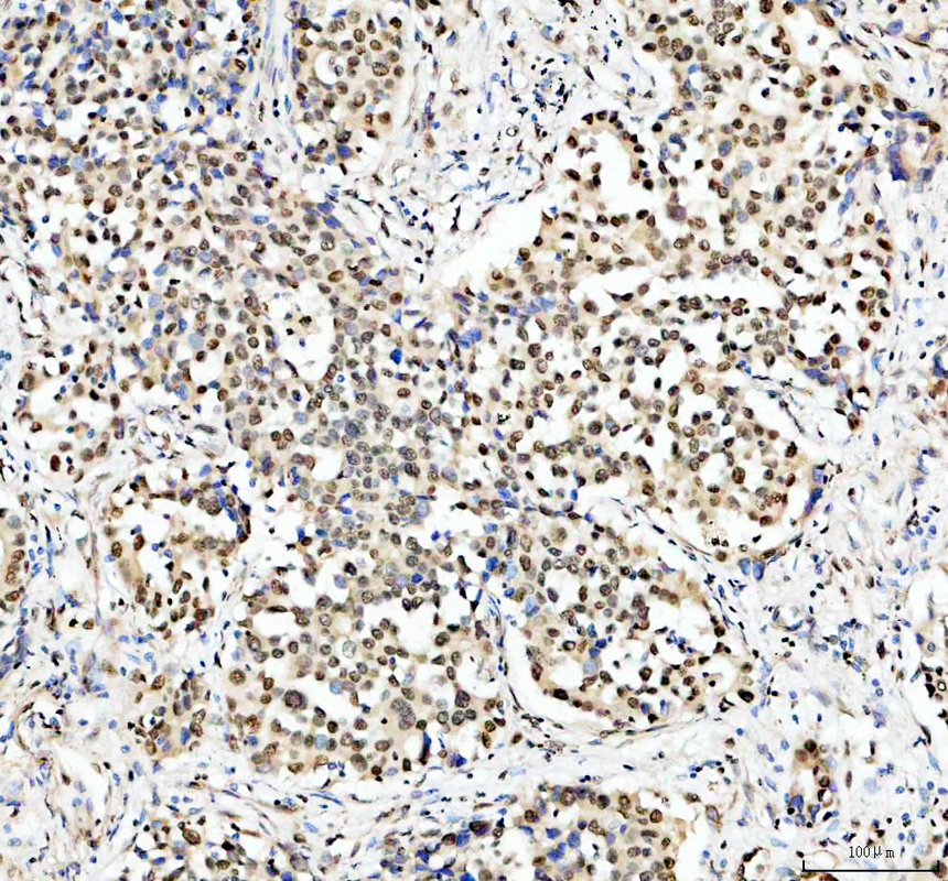 IHC analysis of Histone H2A