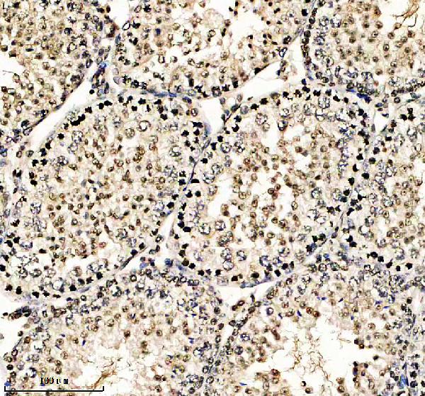 a31256 h2az1 primary antibodies ihc testing 3