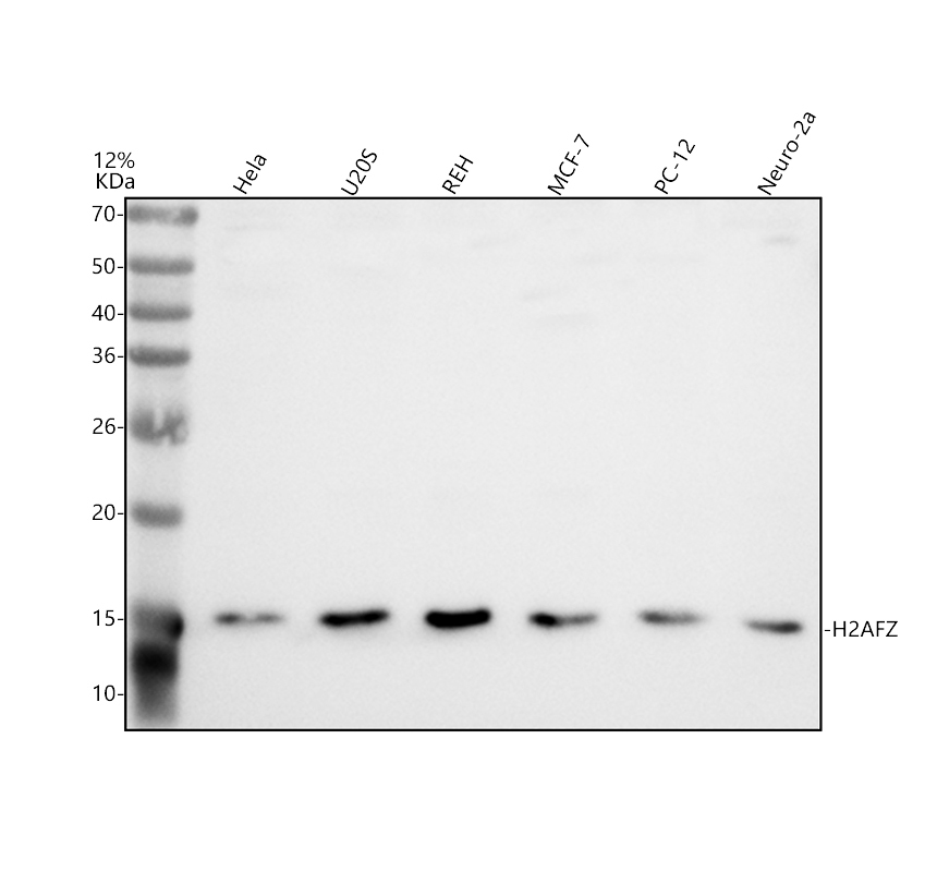 Western blot analysis of Histone H2A