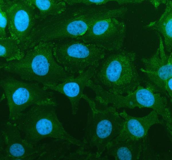 a31546 smcr7l mid51 mief1 primary antibodies if testing 1