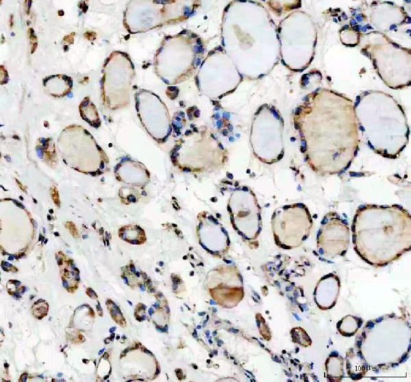 a31589 tomm70 primary antibodies ihc testing 1