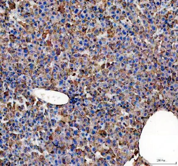 a31589 tomm70 primary antibodies ihc testing 2