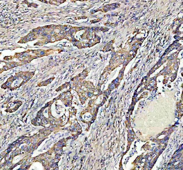 IHC analysis of cGAS using anti-cGAS antibody (A31676-2)