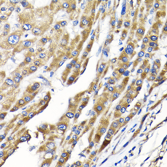 a31687 1 elp1 primary antiboties ihc testing 2