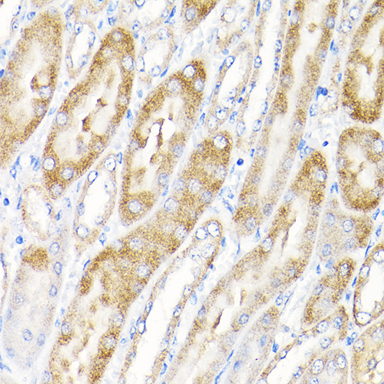 a31687 1 elp1 primary antiboties ihc testing 3