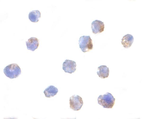 a31687 ikbkap primary antibodies icc testing 2