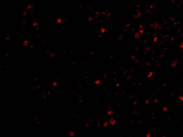 a31687 ikbkap primary antibodies if testing 3