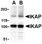 a31687 ikbkap primary antibodies wb testing 1