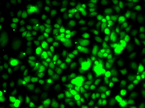 Immunofluorescence analysis of MCF7 cells using TCEB3 antibody 