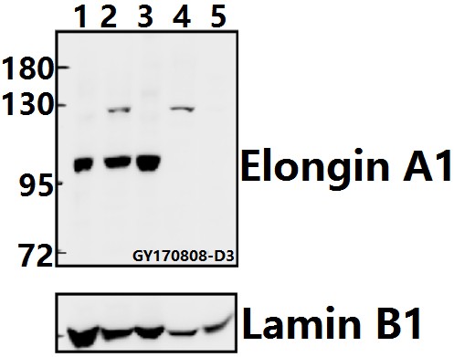 Western blot (WB) analysis of Elongin A1 (R129) pAb at 1:500 dilution
Lane1:HEK293T whole cell lysate(40ug)
Lane2:PC3 whole cell lysate(40ug)
Lane3:K562 whole cell lysate(40ug)
Lane4:H9C2 whole cell lysate(40ug)
Lane5:BV2 whole cell lysate(40ug)