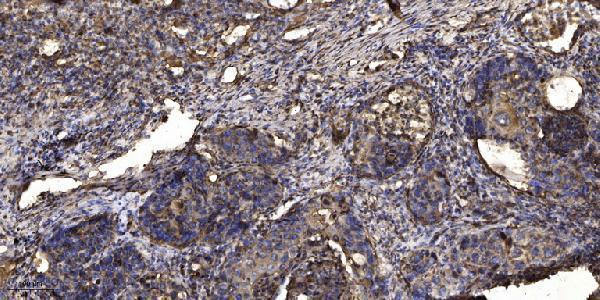 a31717 1 eloa3 primary antibodies ihc testing 1