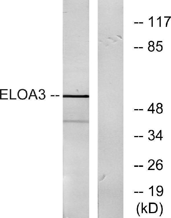 Western blot analysis of lysates from COLO205 cells, using ELOA3 Antibody