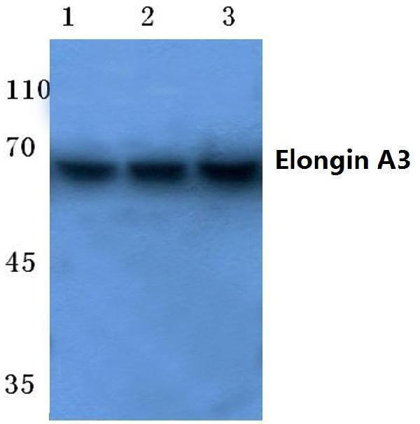 Western blot (WB) analysis of Elongin A3 (E403) polyclonal antibody at 1:500 dilution
Lane1:Jurkat cell lysate
Lane2:Mouse kidney tissue lysate
Lane3:Rat kidney tissue lysate