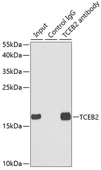 Immunoprecipitation analysis of 150ug extracts of MCF7 cells using 3ug TCEB2 antibody 