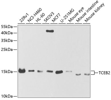 Western blot analysis of extracts of various cell lines, using TCEB2 antibody  at 1:1000 dilution