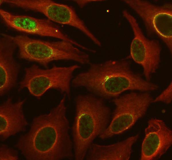 a31721 ess2 primary antibodies if testing 1