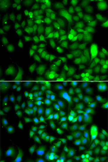 Immunofluorescence analysis of A549 cells using CSRP2BP antibody 