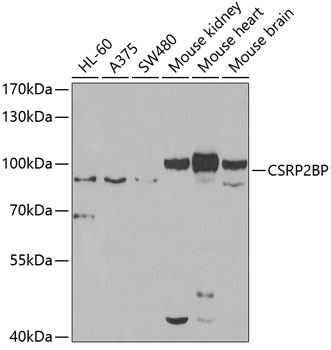 Western blot analysis of extracts of various cell lines, using CSRP2BP antibody  at 1:1000 dilution