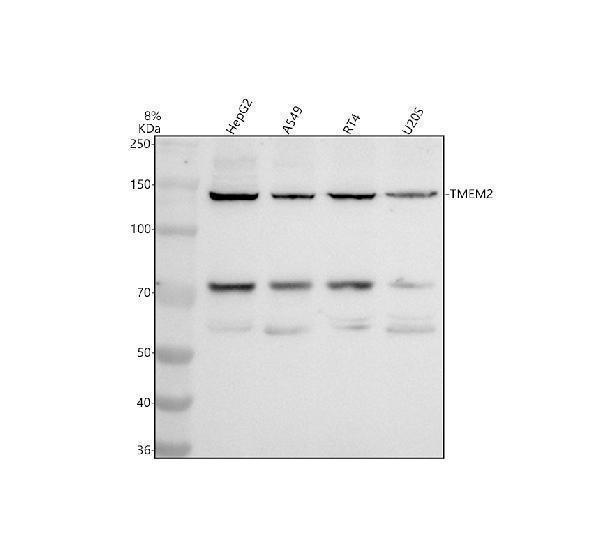 a31759 1 cemip2 primary antibodies wb testing 1
