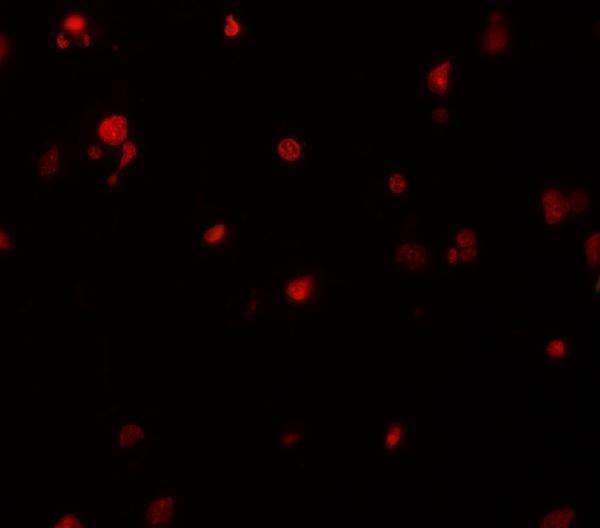 a31772 kiaa0141 primary antibodies if testing 2