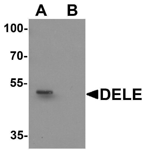 a31772 kiaa0141 primary antibodies wb testing 1