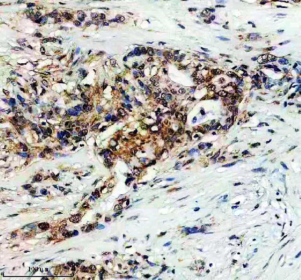a31774 1 dnaaf4 primary antibodies ihc testing 1