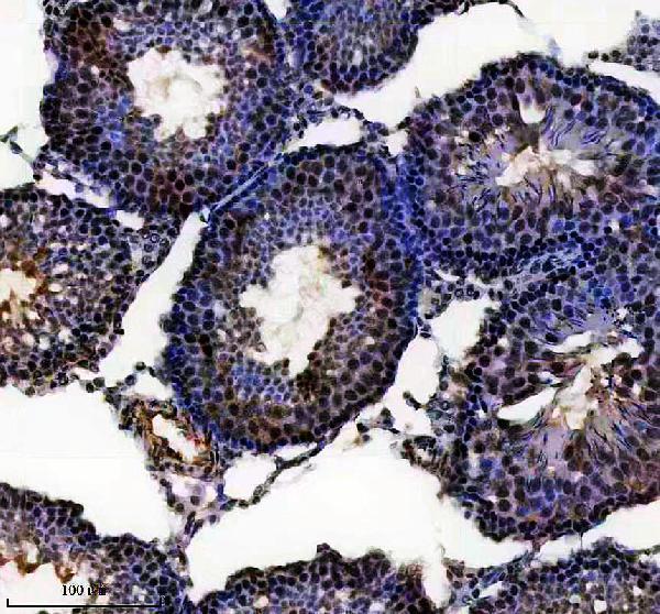 a31774 1 dnaaf4 primary antibodies ihc testing 2
