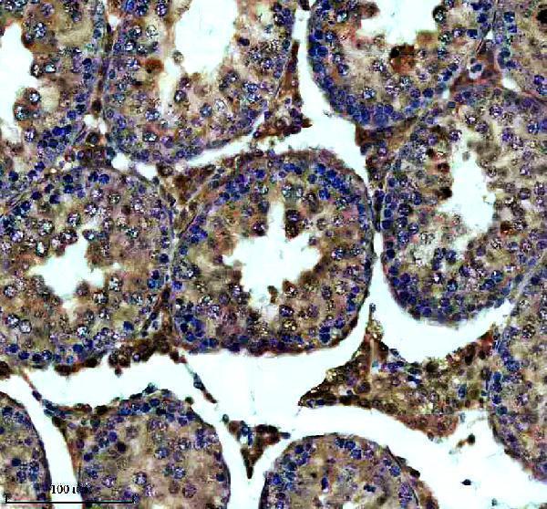 a31774 1 dnaaf4 primary antibodies ihc testing 3