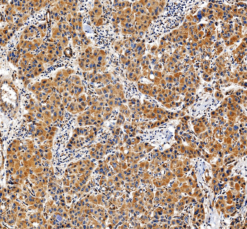 IHC analysis of GUCY1A3/GUCY1A1 using anti-GUCY1A3/GUCY1A1 antibody (A31778-1)
