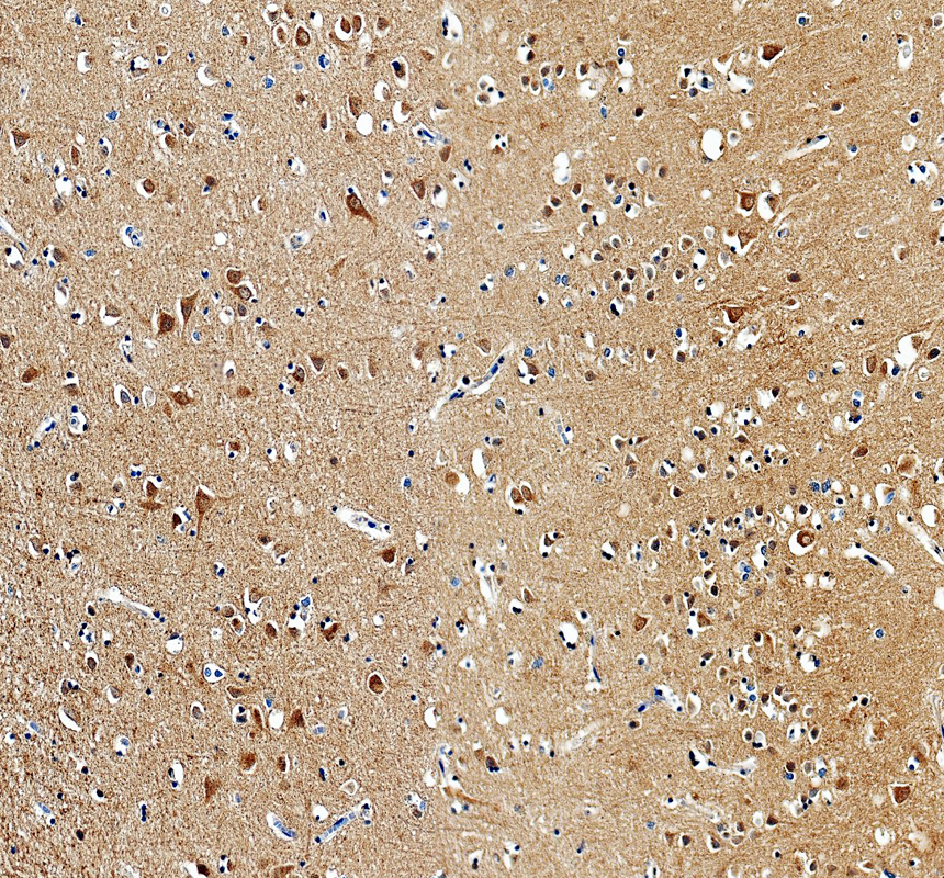 IHC analysis of GUCY1A3/GUCY1A1 using anti-GUCY1A3/GUCY1A1 antibody (A31778-1)