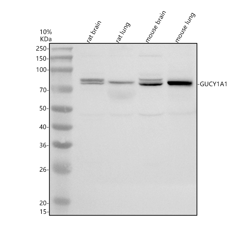 Western blot analysis of GUCY1A3/GUCY1A1 using anti-GUCY1A3/GUCY1A1 antibody (A31778-1)