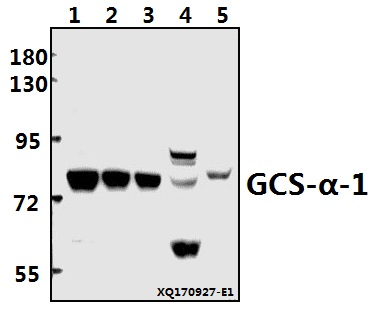 Western blot (WB) analysis of GCS-α-1 (D423) pAb at 1:500 dilution
Lane1:PC3 whole cell lysate(20ug)
Lane2:A549 whole cell lysate(20ug)
Lane3:HEK293T whole cell lysate(20ug)
Lane4:PMVEC whole cell lysate(40ug)
Lane5:The Brain tissue lysate of Mouse(40ug)