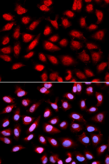 a31784 ptpa primary antiboties if testing 1