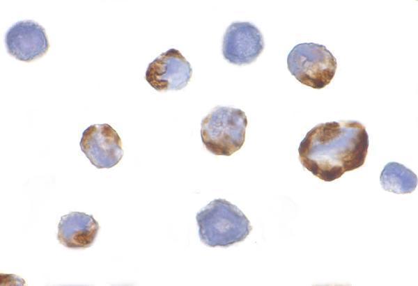 a31791 pak7 primary antibodies icc testing 2