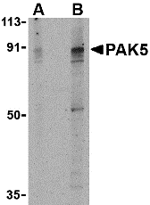 a31791 pak7 primary antibodies wb testing 1