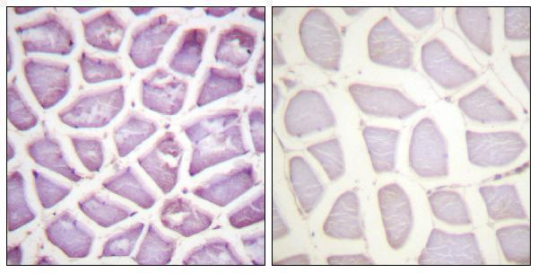 Immunohistochemistry analysis of paraffin-embedded human skeletal muscle, using Parkin (Phospho-Ser131) Antibody