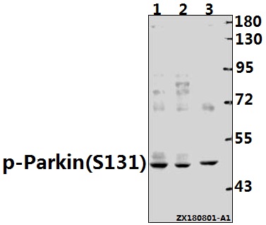 Western blot (WB) analysis of p-Parkin (S131) pAb at 1:500 dilution
Lane1:MCF-7 whole cell lysate(40ug)
Lane2:HCT116 whole cell lysate(40ug)
Lane3:SGC7901 whole cell lysate(40ug)