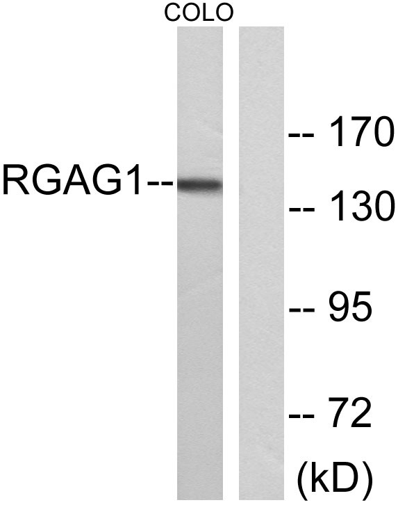 Western blot analysis of lysates from COLO cells, using RGAG1 Antibody