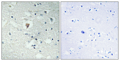 Immunohistochemistry validation of RTL6 using Anti-LDOC1L RTL6 Antibody (A31816)