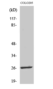 Western blotting validation for Anti-LDOC1L RTL6 Antibody A31816
Western Blot (WB) analysis of specific cells using LDOC1L polyclonal antibody