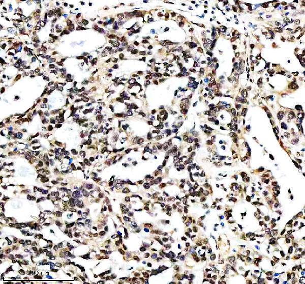  IHC analysis of C14orf166/RTRAF using anti-C14orf166/RTRAF antibody (A31823-2)