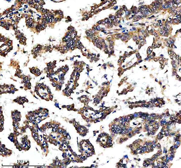  IHC analysis of C14orf166/RTRAF using anti-C14orf166/RTRAF antibody (A31823-2)