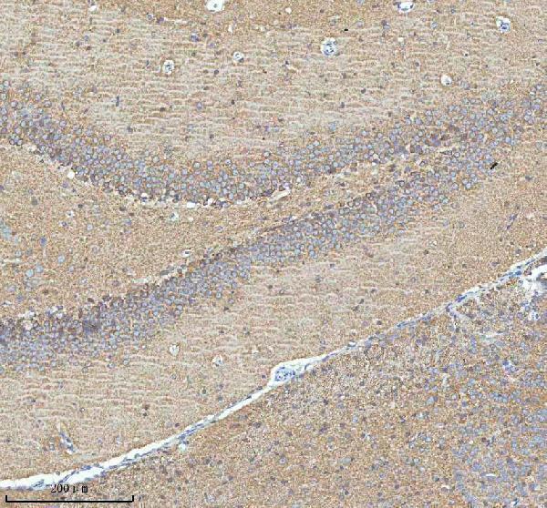 a31869 1 hdhd5 primary antibodies ihc testing 11