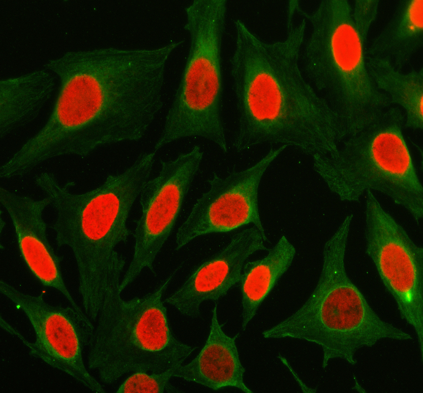 a31884 2 hpf1 primary antibodies if testing 1